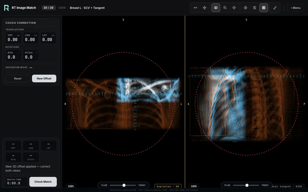 Breast L · SCV + Tangent, trainer screenshot