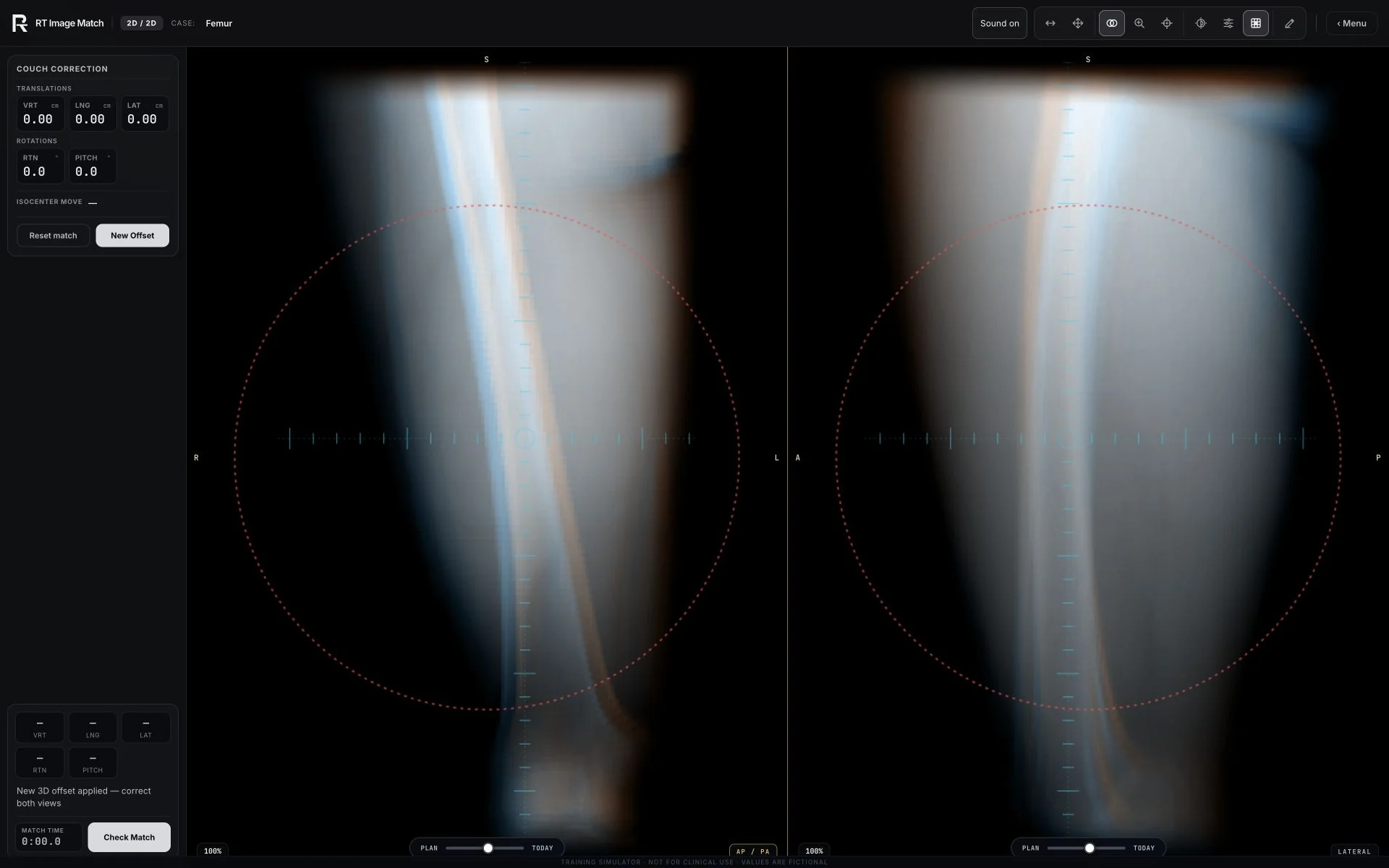 Femur, trainer screenshot
