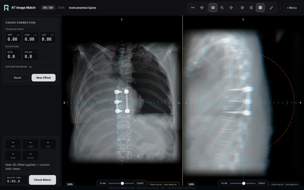 Instrumented Spine, trainer screenshot