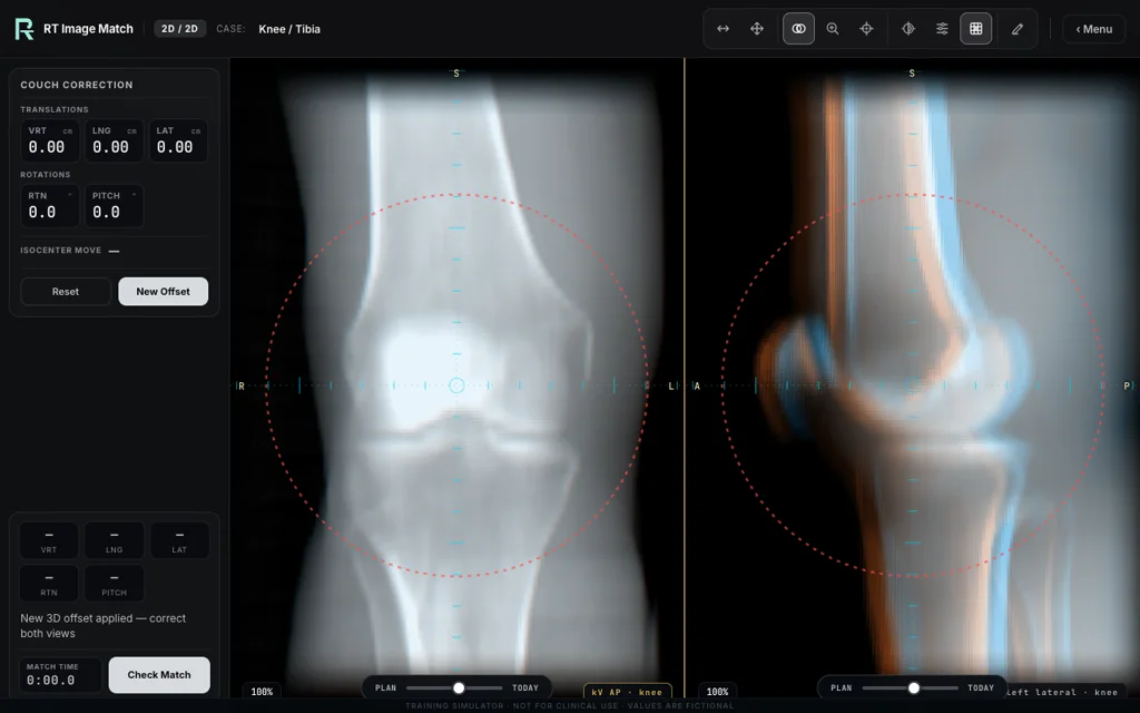 Knee / Tibia, trainer screenshot