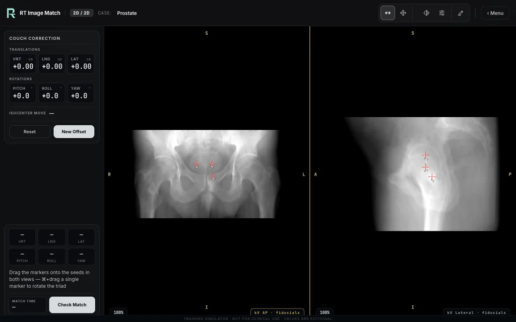 Prostate, trainer screenshot