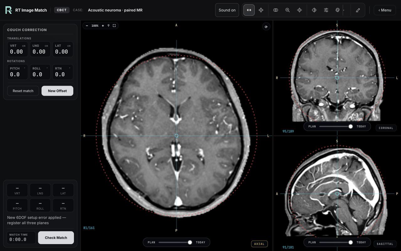 Acoustic neuroma · paired MR, trainer screenshot