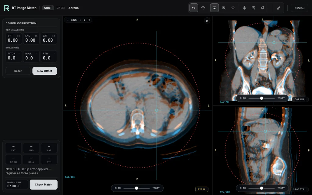 Adrenal, trainer screenshot