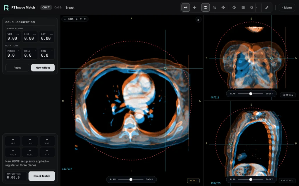 Breast, trainer screenshot