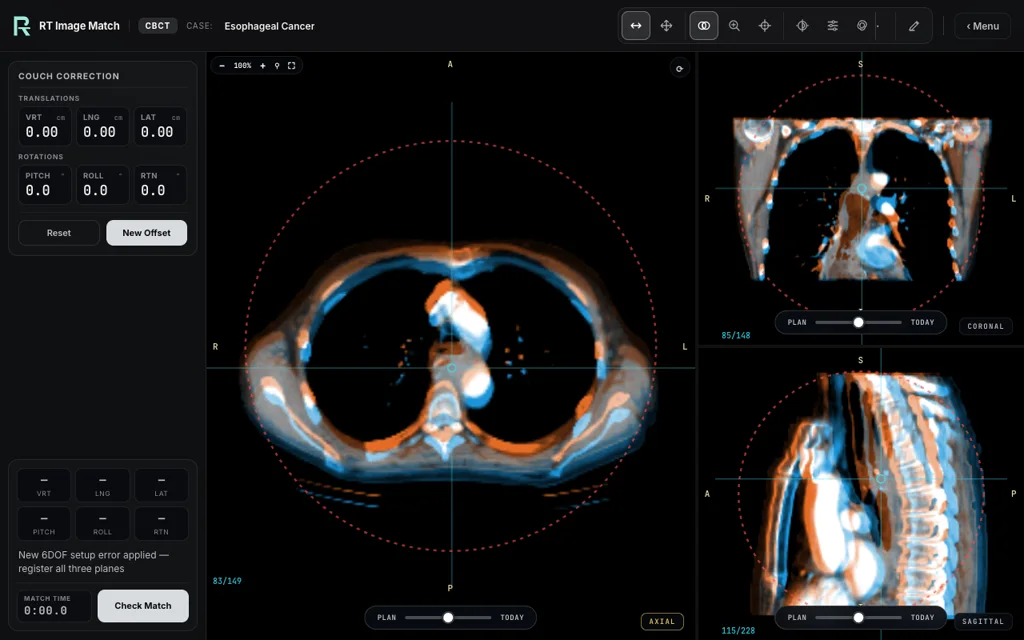 Esophageal Cancer, trainer screenshot