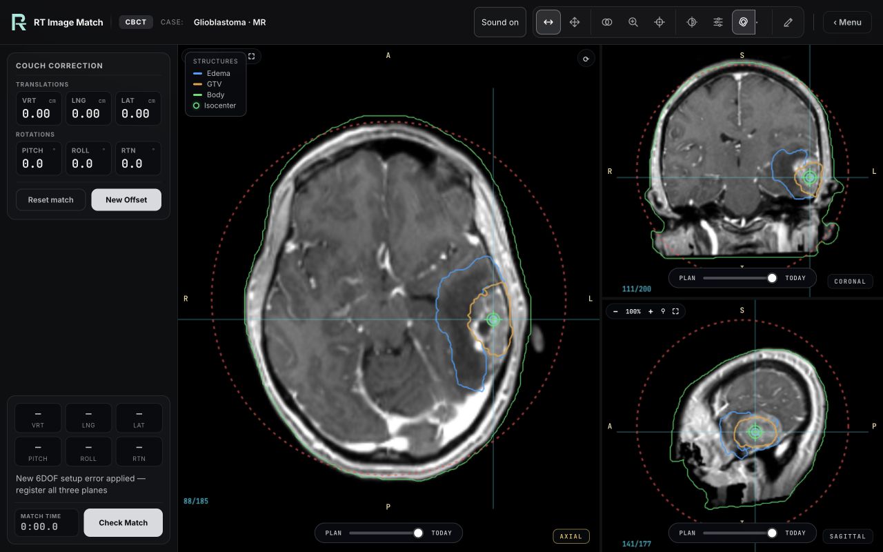 Glioblastoma · MR, trainer screenshot