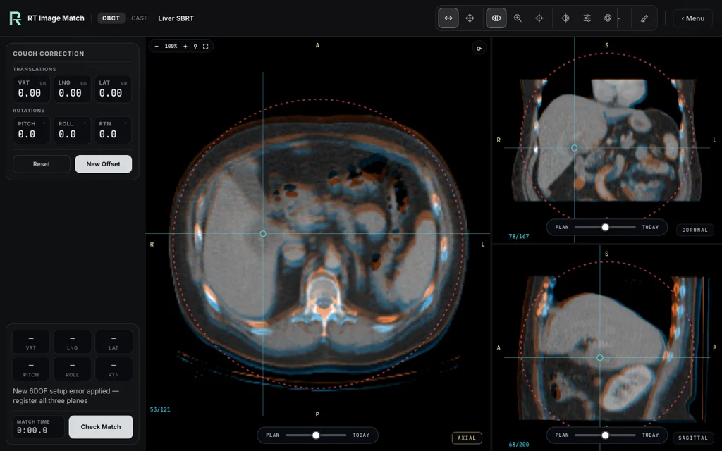 Liver SBRT, trainer screenshot