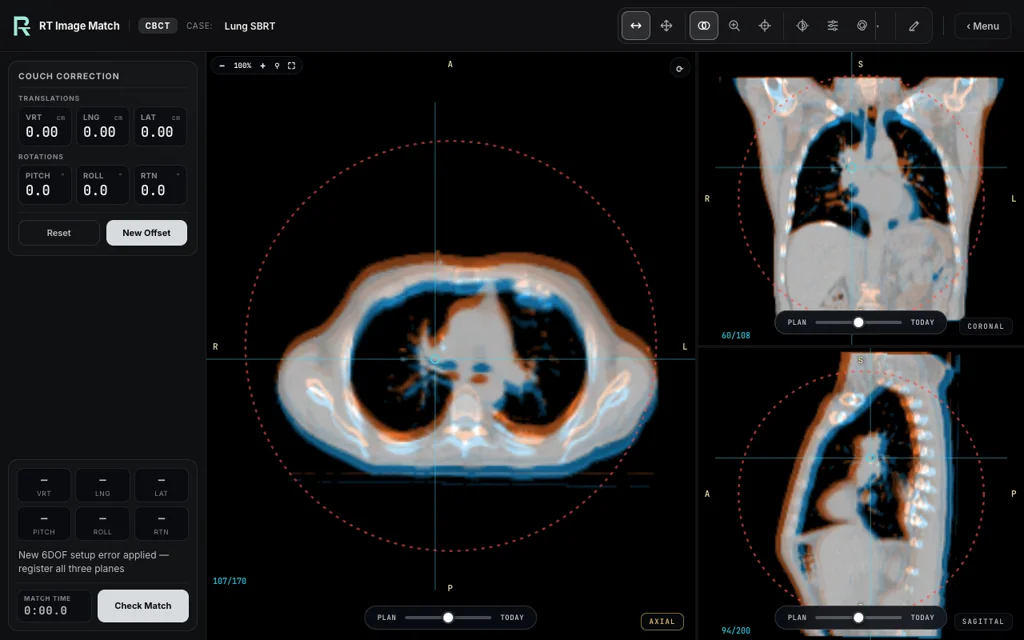 Lung · conventional RT, trainer screenshot