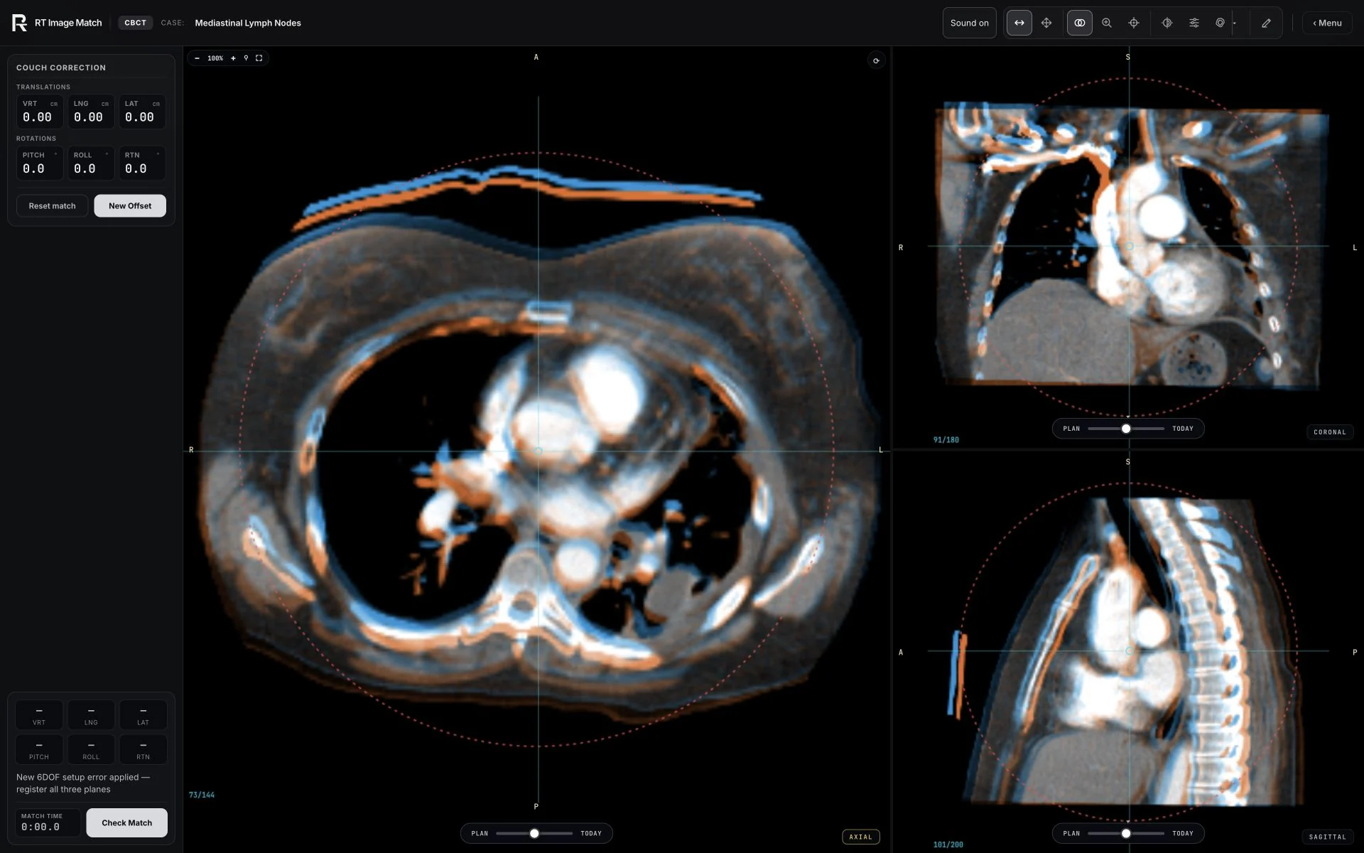 Mediastinal Lymph Nodes, trainer screenshot