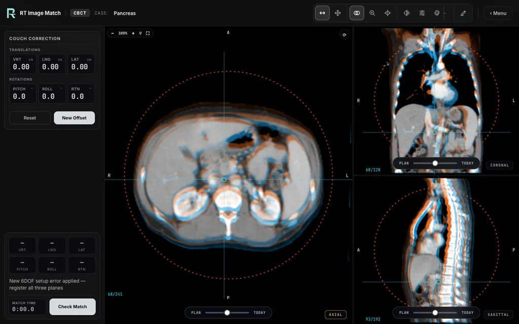 Pancreas, trainer screenshot