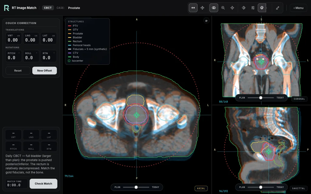Prostate, trainer screenshot