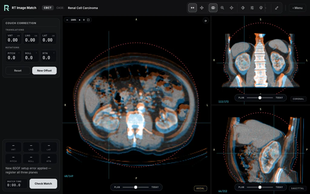 Renal Cell Carcinoma, trainer screenshot