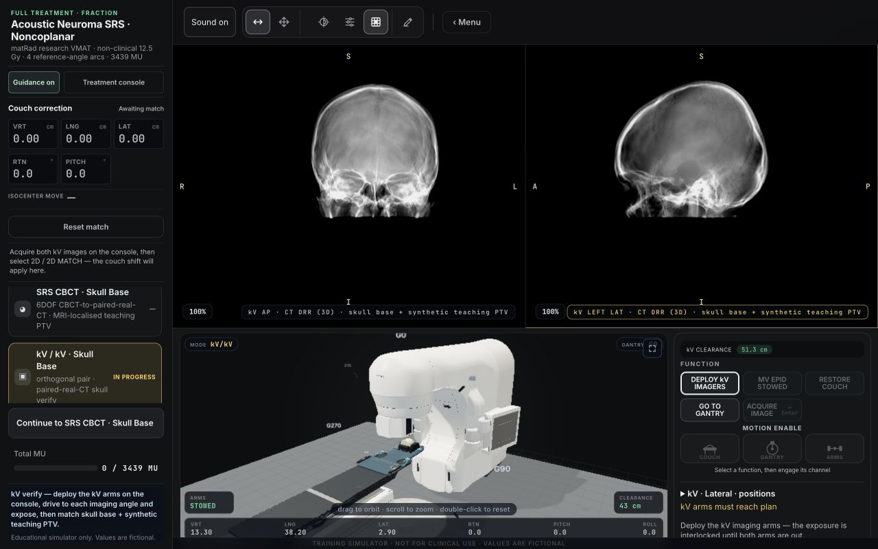 Earlier Acoustic Neuroma SRS skull-verification preparation with the linac; the current Cranial SRS case uses PROTEAS P28.