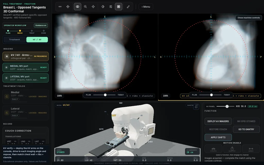 Breast L · Field-in-Field Tangents, trainer screenshot