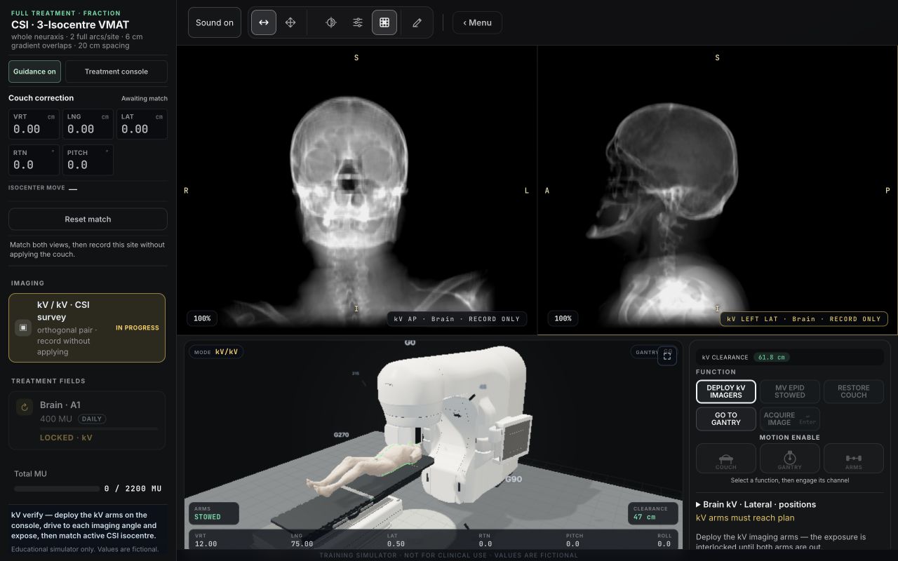 CSI · 3-Isocentre VMAT, trainer screenshot