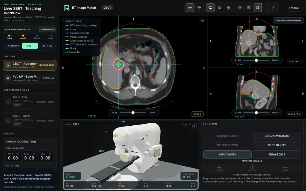 Liver SBRT · VMAT, trainer screenshot