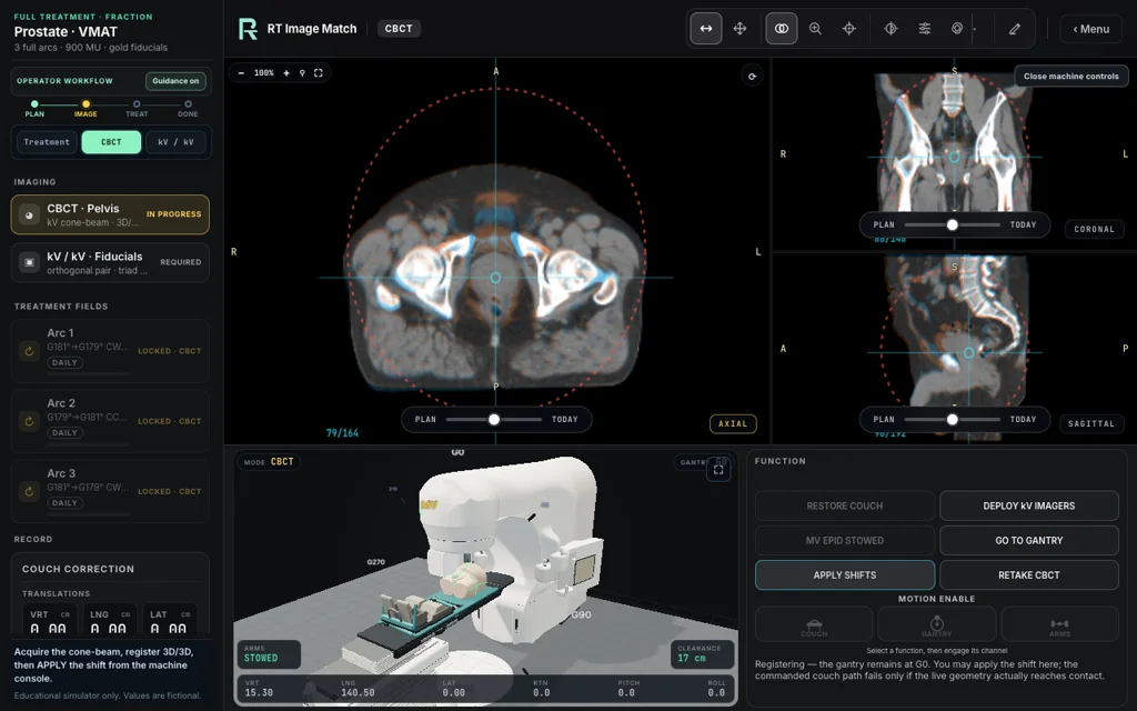 Prostate · VMAT, trainer screenshot